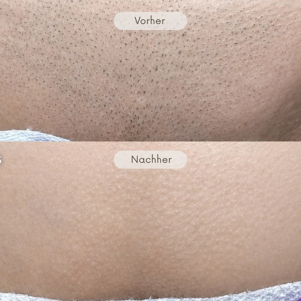 3 in 1 Intimrasierer